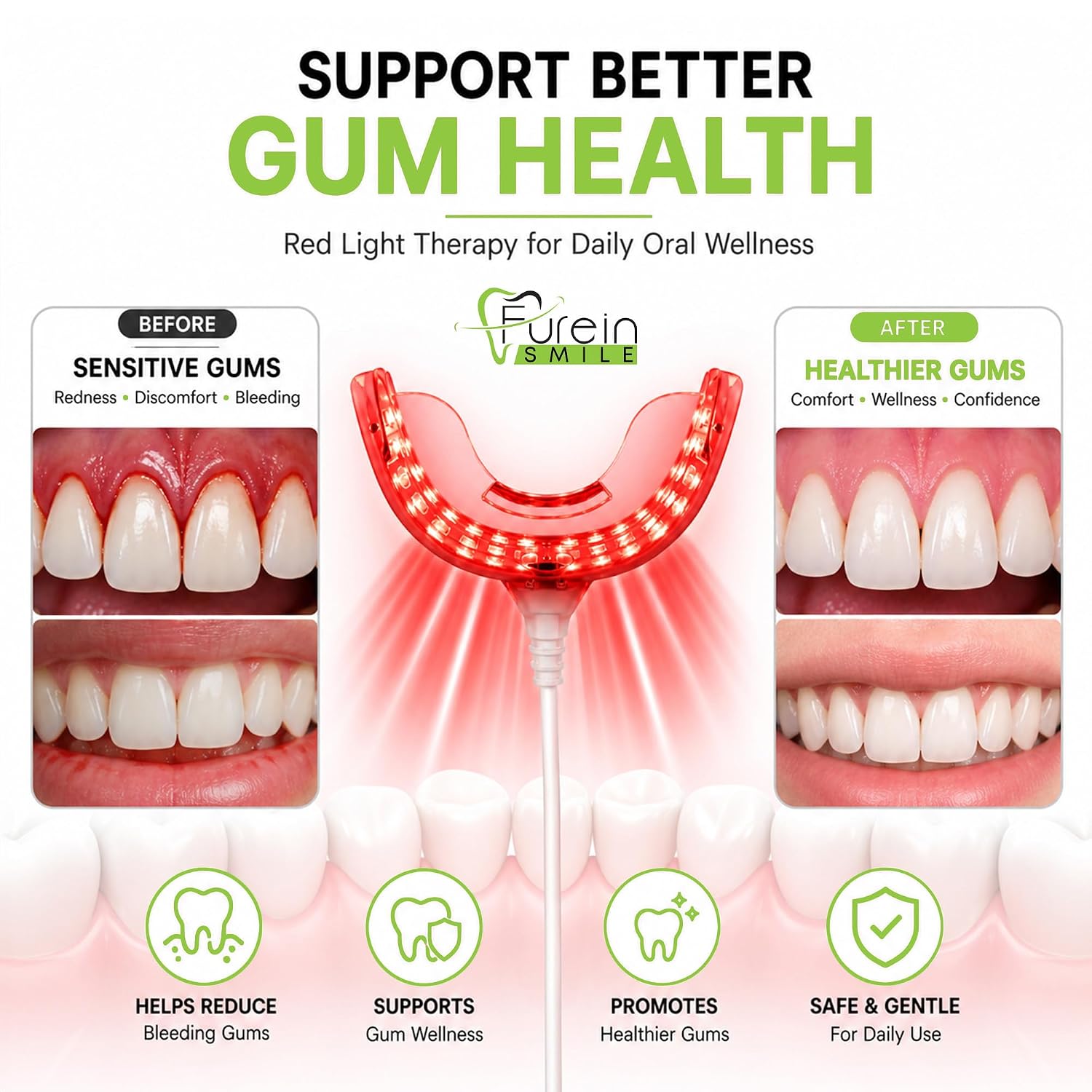 Red Light Gum Therapy Device for Toothache & Oral Care